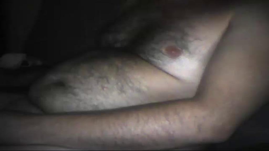casalbrrs